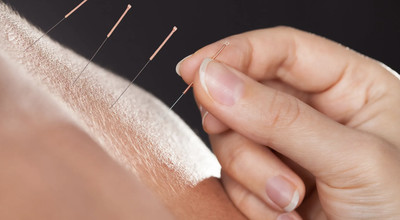 Link to: /programs/acupuncture-herbal-medicine