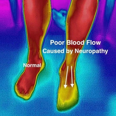 Link to: /programs/natural-neuropathy-healing